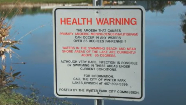 Health officials warn of deadly brain-eating amoeba as summer approaches
