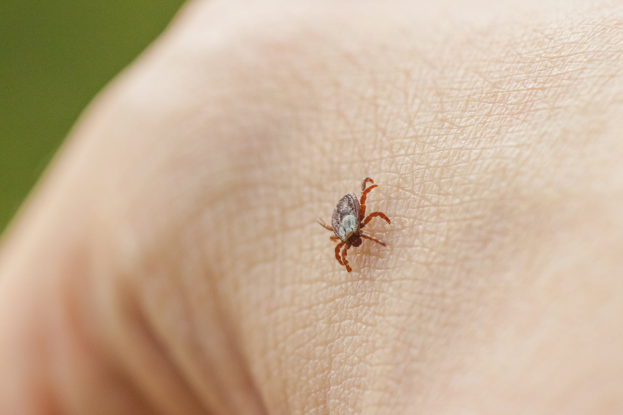 Federal officials unveil new plan in the fight against Lyme disease and tick-borne illness